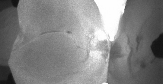 The first photo taken on October 20, 2014.